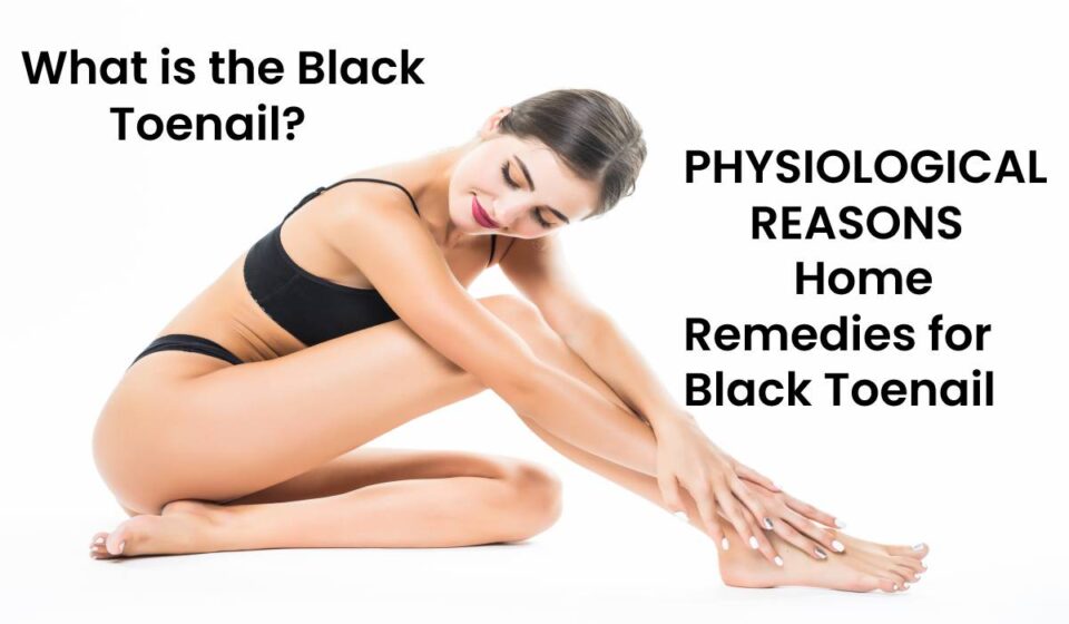 Home Remedies for Black Toenail